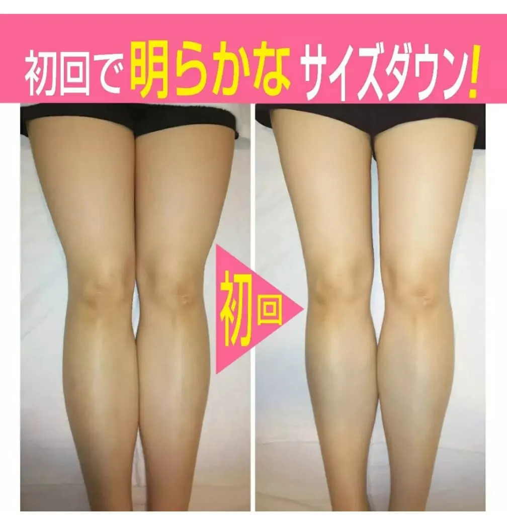 施術前後の脚の比較写真。美脚コース初回の変化