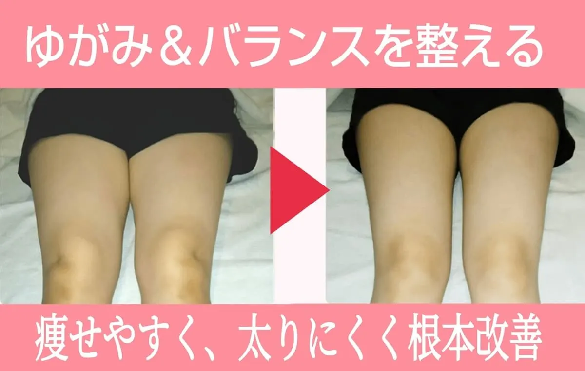 施術前後の脚の比較写真。ゆがみとバランスを整えた変化