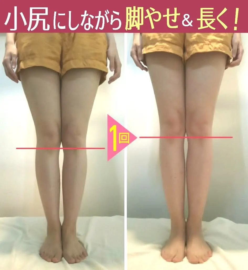 施術前後の脚の比較写真。ラインで脚の傾きを示した1回目の変化