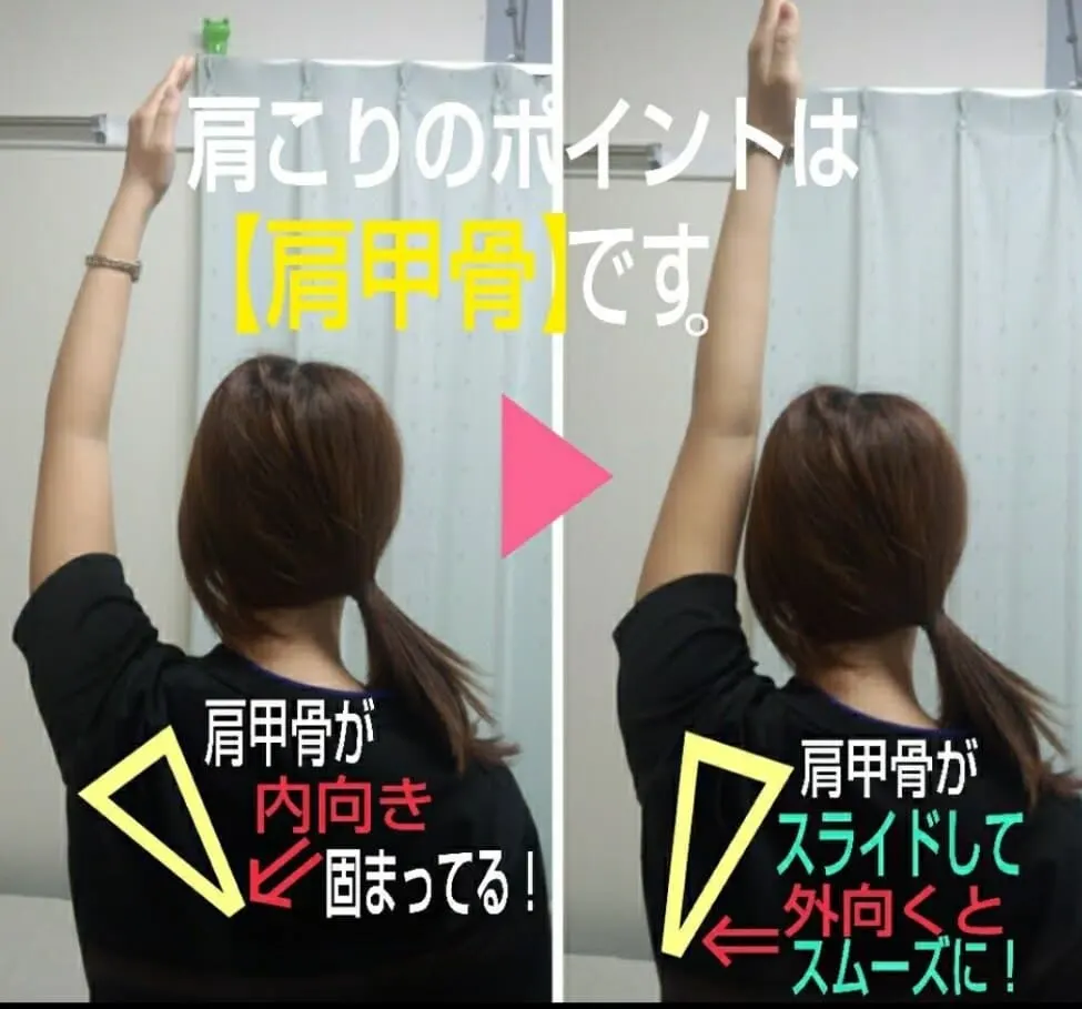 施術前後の背中と肩甲骨まわりの比較写真。姿勢を整えた変化