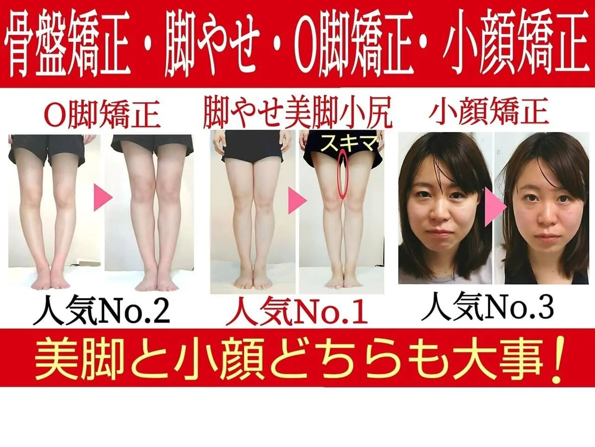 小顔矯正の施術前後。お顔まわりの変化を並べた写真
