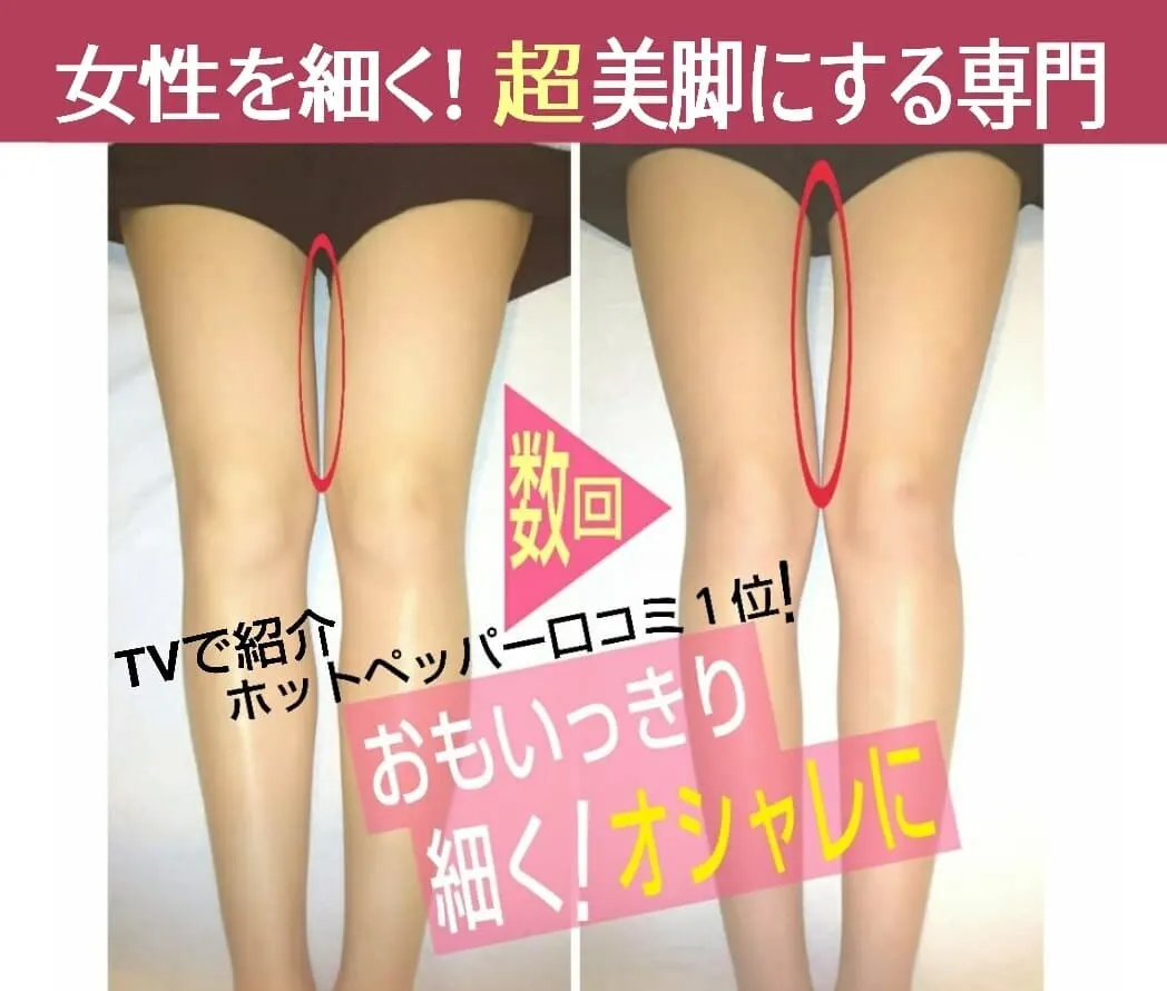 美脚コースの施術前後。数回の施術で、内ももの間にすき間ができた脚の比較写真
